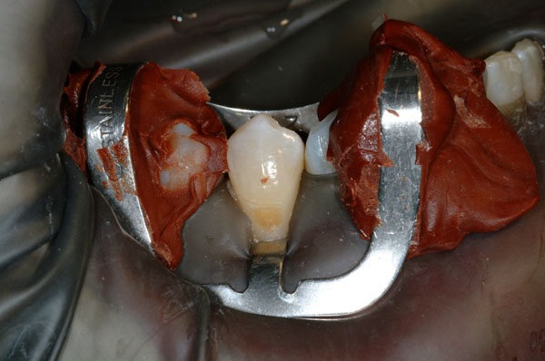 Dr. Ed Kardong 01 Pre-Op