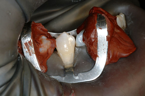 Dr. Ed Kardong 02 Prep